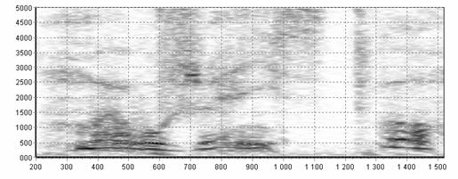 Spektrogram głosu osoby po laryngektomii