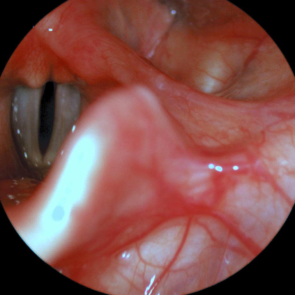 oświetlacz endoskopowy diagnostyka laryngologiczna foniatryczna