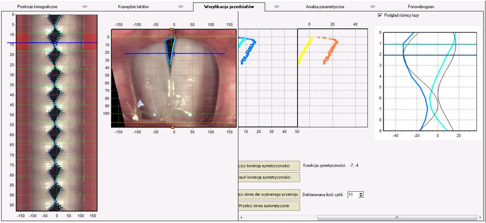 Okno analizy kimograficznej nagrania HSV – Analiza kimo krótkoczasowa -> Weryfikacja przedziałów; podgląd różnicy faz 