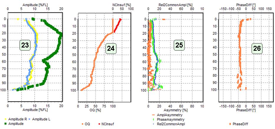 Okno analizy kimograficznej nagrania HSV – Analiza kimo krótkoczasowa -> Analiza parametryczna