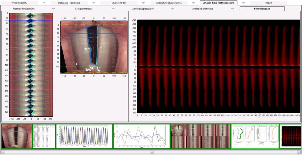 Okno analizy kimograficznej nagrania HSV – Analiza kimo krótkoczasowa -> Fonowibrogram