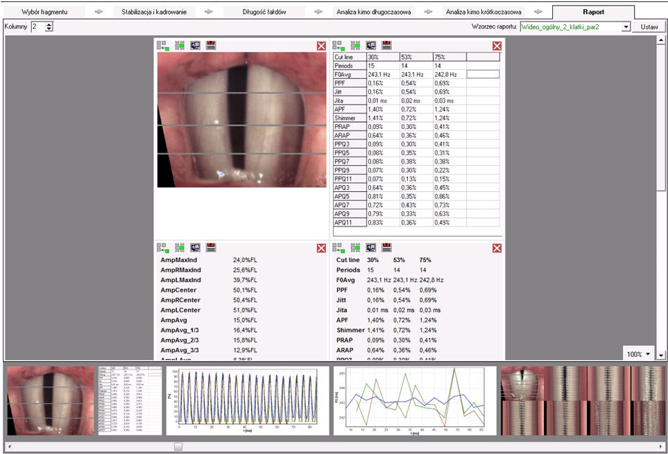Okno analizy kimograficznej nagrania HSV – Raport