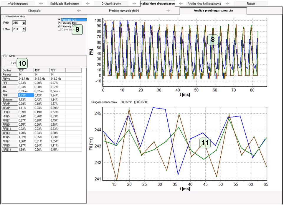 Okno analizy kimograficznej nagrania HSV – Analiza kimo długoczasowa -> Analiza przebiegu rozwarcia